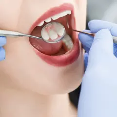 Dentysta: Cennik usług, NFZ i jak zaplanować budżet?