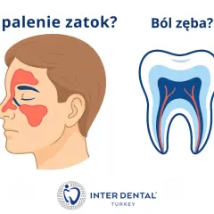 Zapalenie zatok czy ból zęba? Ilustracja porównuje objawy zapalenia zatok z budową zęba, sugerując, że ból zębów może być mylony z innymi dolegliwościami.