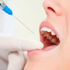 Jak się znieczulić przed dentystą? Bezbolesne metody i spokój