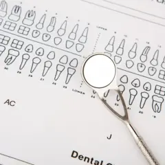 Dentysta pokazuje, jak liczyć zęby na schemacie. Lusterko dentystyczne leży na diagramie zębów.