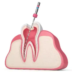 Ból zęba? Sprawdź, czy to leczenie kanałowe i kiedy do dentysty