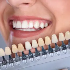 Kolor zębów B1 czy B2? Naturalny uśmiech vs. Hollywoodzki blask