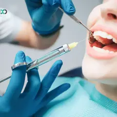 Znieczulenie u dentysty: Bezpieczne? Rozwiewamy wszystkie wątpliwości!