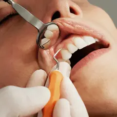 Dentysta bada zęby, by ocenić próchnicę zębów jak leczyć.