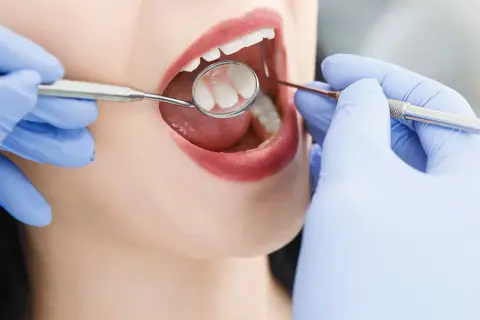 Dentysta: Cennik usług, NFZ i jak zaplanować budżet?