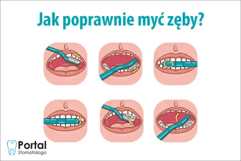 Jak myć zęby szczoteczką soniczną? Perfekcyjna higiena krok po kroku