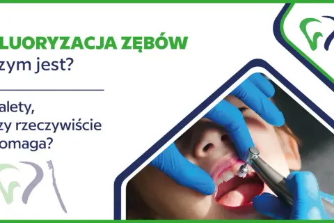 Fluororyzacja zębów: czy fluor jest szkodliwy? Zabieg, jego zalety i czy rzeczywiście pomaga.
