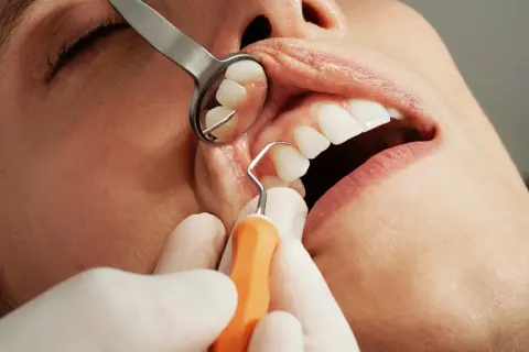 Dentysta bada zęby, by ocenić próchnicę zębów jak leczyć.