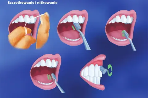 Nitkowanie zębów przed czy po myciu? Nauka ma odpowiedź!