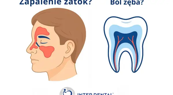 Zapalenie zatok czy ból zęba? Ilustracja porównuje objawy zapalenia zatok z budową zęba, sugerując, że ból zębów może być mylony z innymi dolegliwościami.