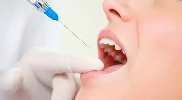 Jak się znieczulić przed dentystą? Bezbolesne metody i spokój