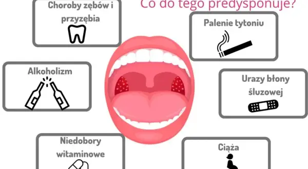 Jak szybko złagodzić zapalenie w jamie ustnej? Domowe i apteczne metody