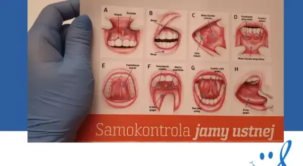 Rak jamy ustnej: Jak rozpoznać objawy i ratować życie? Poradnik