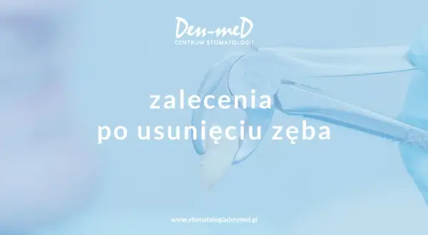 Antybiotyk po wyrwaniu zęba: Kiedy TAK, a kiedy NIE?