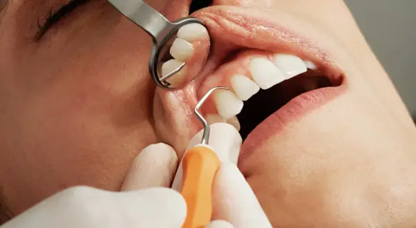 Dentysta bada zęby, by ocenić próchnicę zębów jak leczyć.