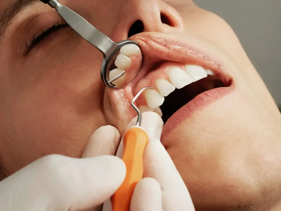 Dentysta wykonuje skaling zębów, używając narzędzi i lusterka stomatologicznego.
