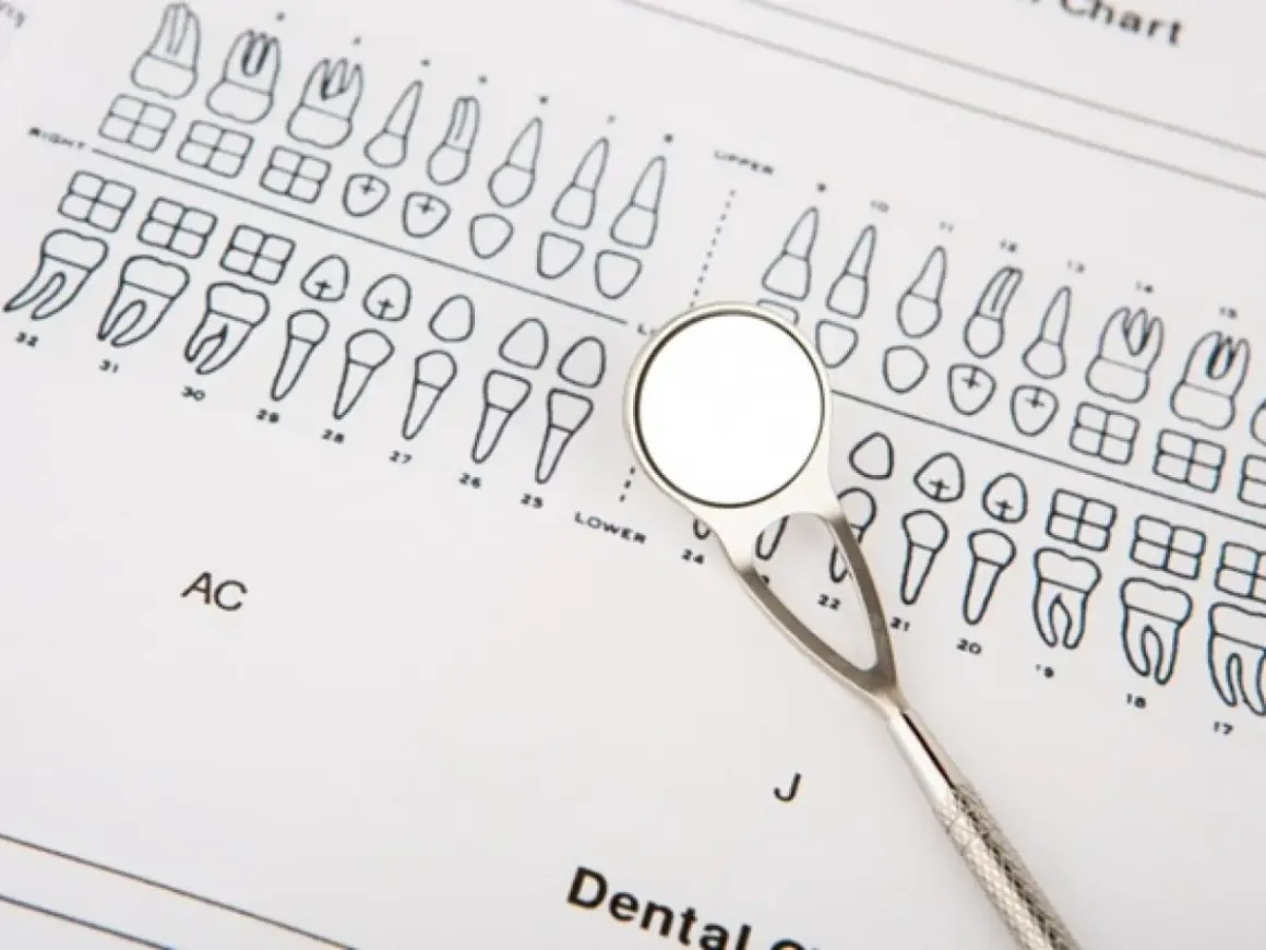 Dentysta pokazuje, jak liczyć zęby na schemacie. Lusterko dentystyczne leży na diagramie zębów.