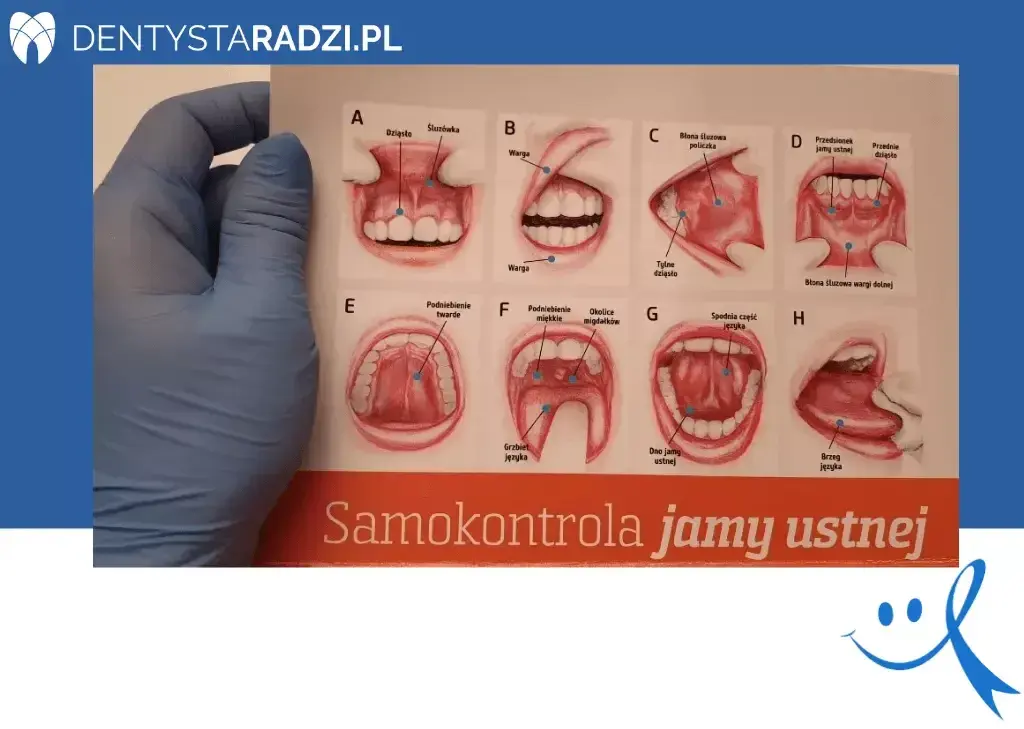 Rak jamy ustnej: Jak rozpoznać objawy i ratować życie? Poradnik