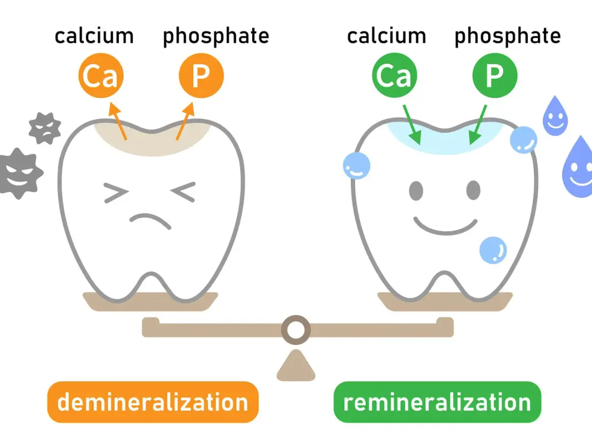 Ząb po demineralizacji jest smutny, a po remineralizacji szkliwa – uśmiechnięty. Widać procesy odbudowy.