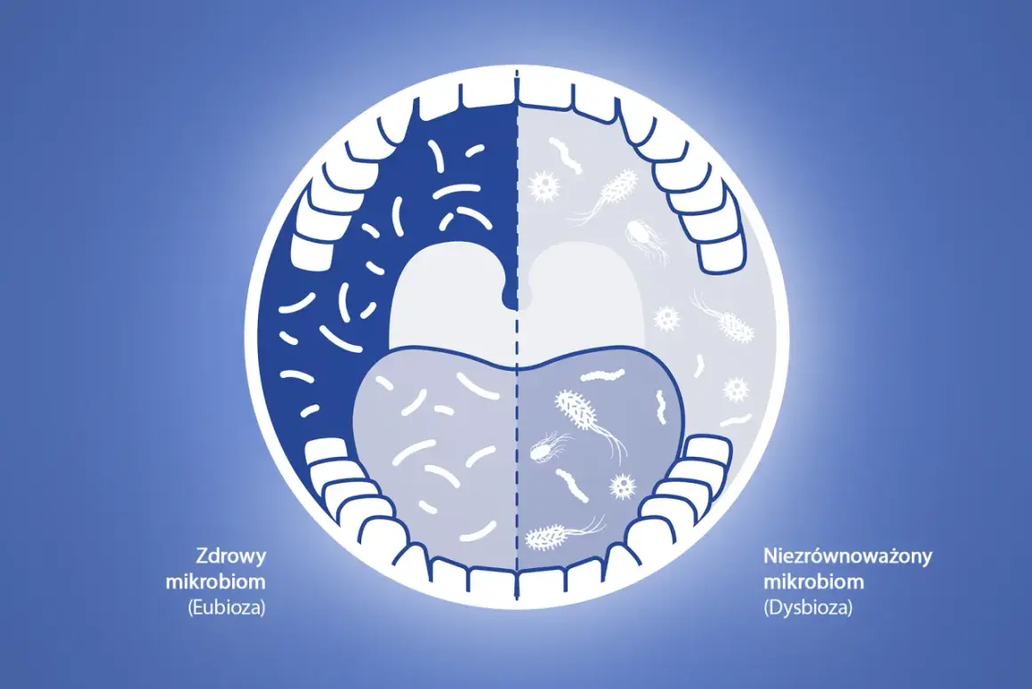Ilustracja porównuje zdrowy i niezrównoważony mikrobiom jamy ustnej. Płyny do płukania jamy ustnej skutki uboczne mogą prowadzić do dysbiozy.
