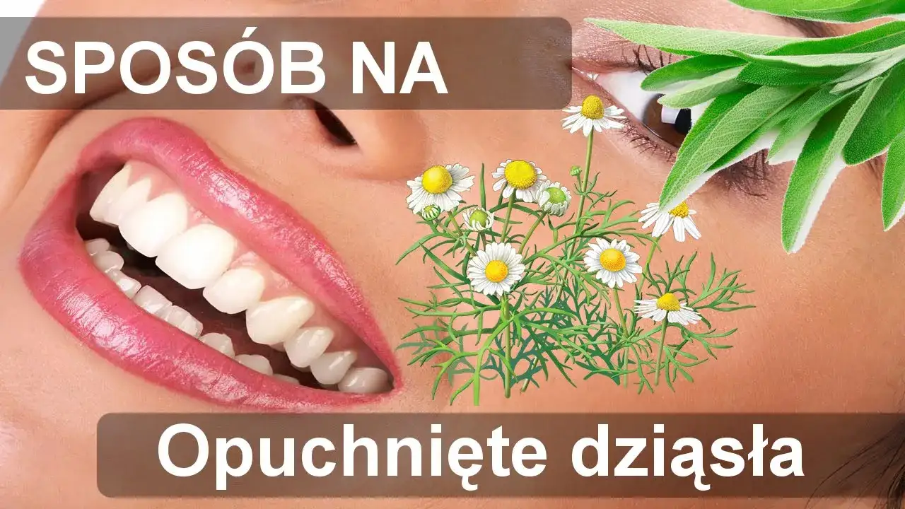 domowe sposoby na opuchnięte dziąsła
