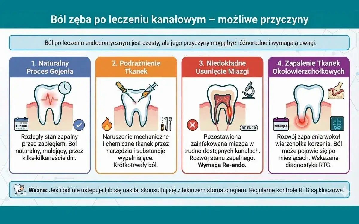 objawy chorego zęba, ząb do leczenia kanałowego infografika