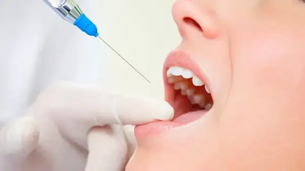 Jak się znieczulić przed dentystą? Bezbolesne metody i spokój