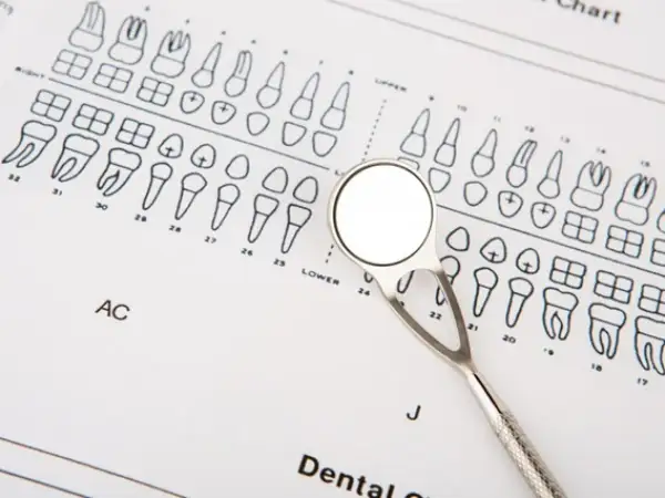 Dentysta pokazuje, jak liczyć zęby na schemacie. Lusterko dentystyczne leży na diagramie zębów.