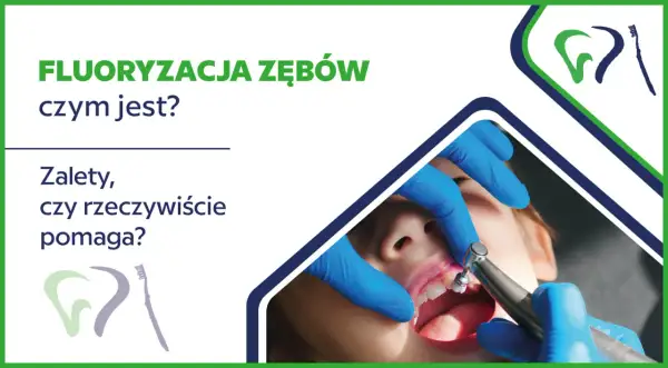 Fluororyzacja zębów: czy fluor jest szkodliwy? Zabieg, jego zalety i czy rzeczywiście pomaga.