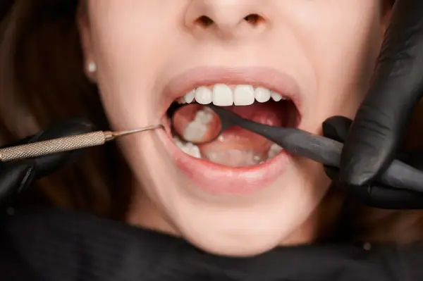 Uśmiech z widocznymi, białymi zębami, w tym siódemki, badany przez dentystę w czarnych rękawiczkach przy użyciu lusterka i sondy.