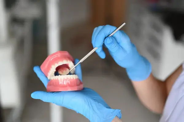 Ręka w niebieskiej rękawiczce pokazuje model szczęki, używając narzędzia dentystycznego. To może być alternatywa co zamiast nici dentystycznej.